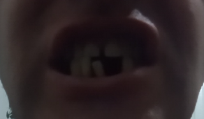 Ajuda para cirurgia dental