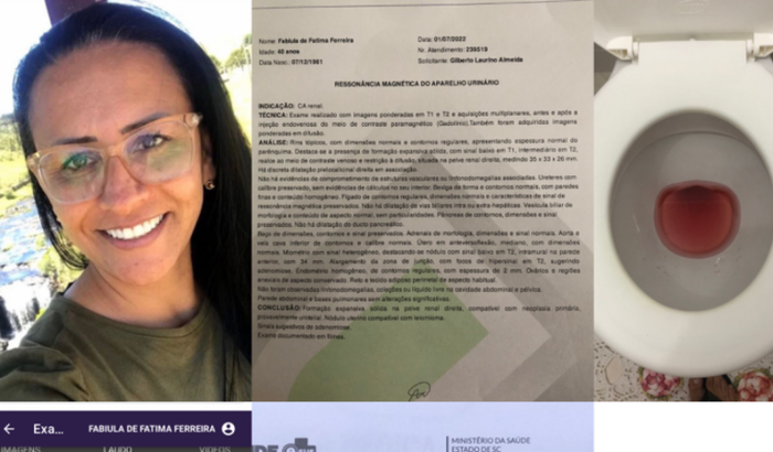 Cirurgia da Fabi (Nefroureterectomia)