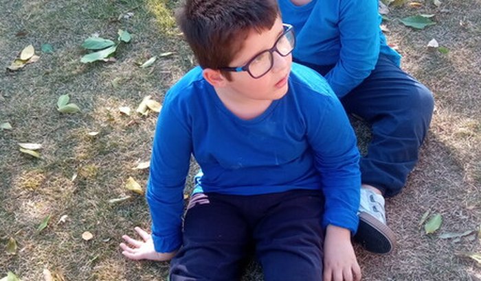 Tratamento dos gêmeos Rafa e Titi 