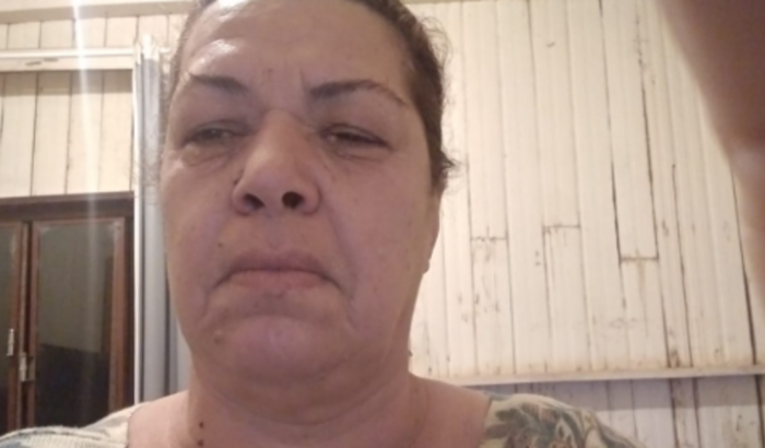 COÁGULO NO OLHO - EXAMES