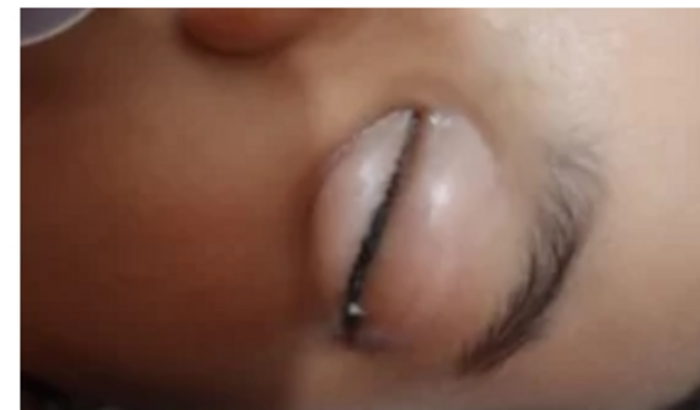 Tratamento de vista!!!!!!