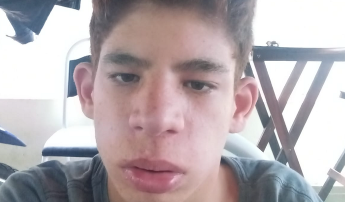 Ajuda para jose renato autista com escoleose