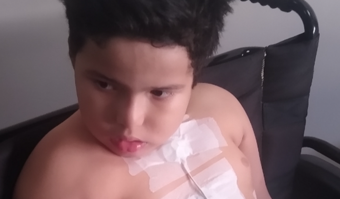 Estadia - Cirurgia do ❤️ Pedro Paulo meu filho 