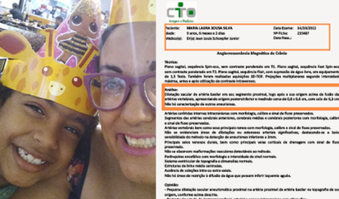 Minha filha terá que operar um aneurisma celebra raríssimo.