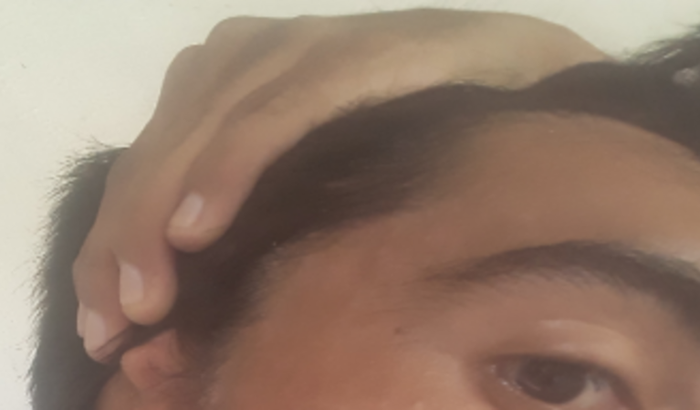 Ajuda para uma cirurgia na orelha direita