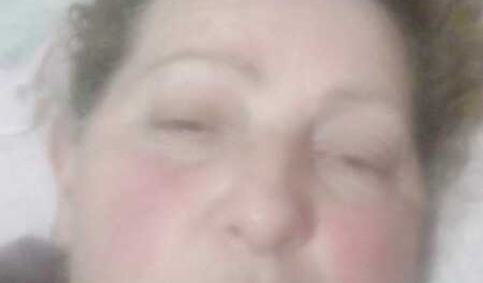 Ajuda para nossa mãe.Que precisa fazer cirurgia 