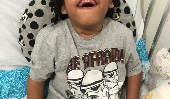 Ajuda para custear o tratamento com CBD(canabidiol) compra o meu leite ( ketocal4:1) e fraldas 