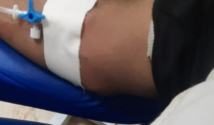 Ajude na minha cirurgia.