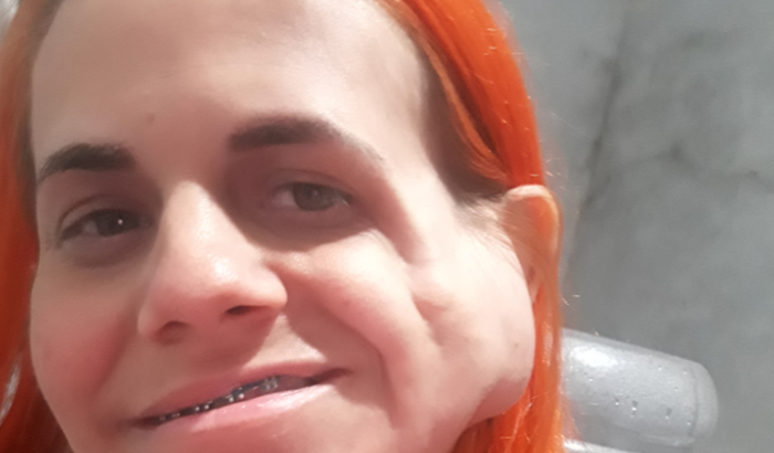 Ajuda pra fazer uma cirurgia de preenchimento facial100