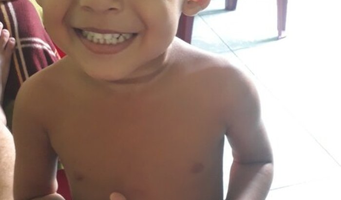 Ajuda para joao miguel fazer uma cirurgia retirada as amígdalas