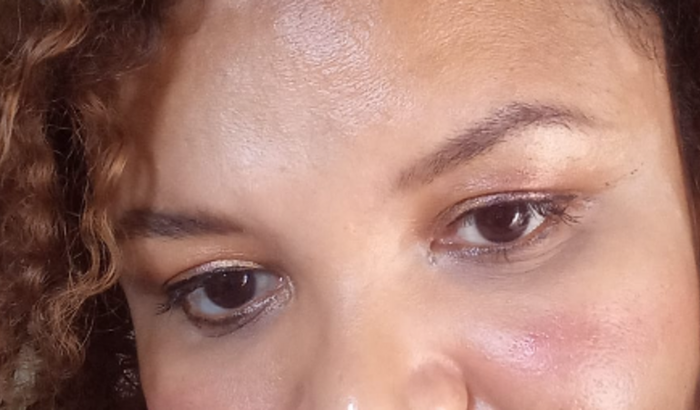 Fibromialgia uma dor que você não vê 