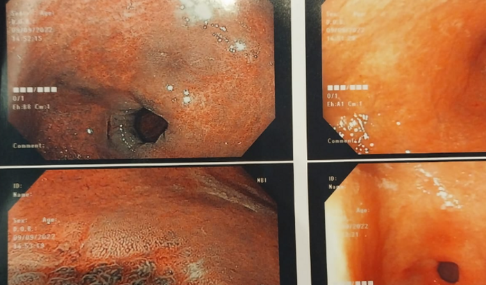 Contribuição para a cirurgia do netinho e da filha de D. Meire
