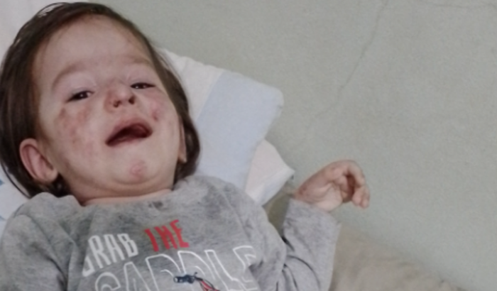 Ajuda o João Guilherme realizar os exames específicos genéticos para encontrar um diagnóstico 