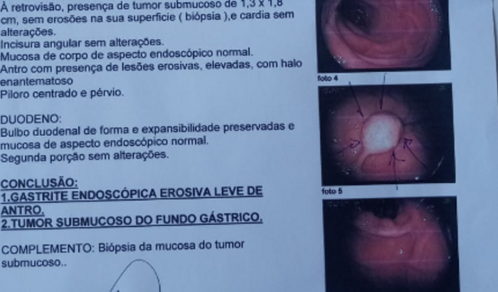 Ajuda para Ecoendoscopia