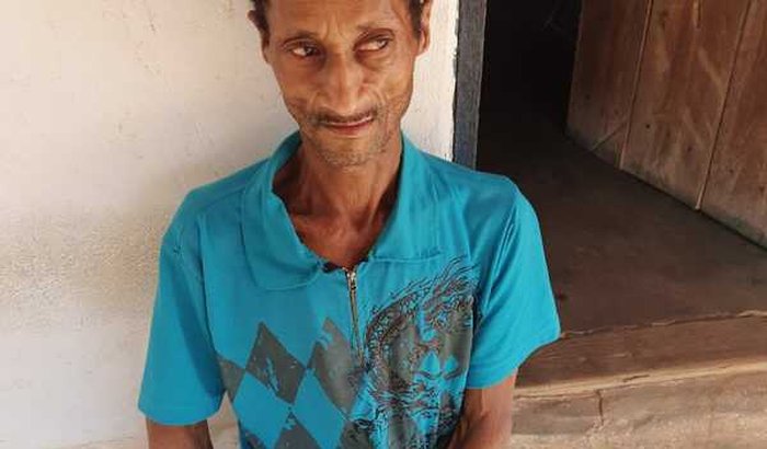 Ajuda tratamento de C.A no esôfago 