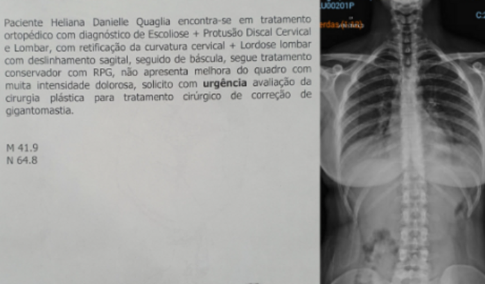 Cirurgia da Lili
