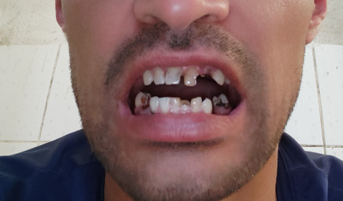 Ajuda prós dentes