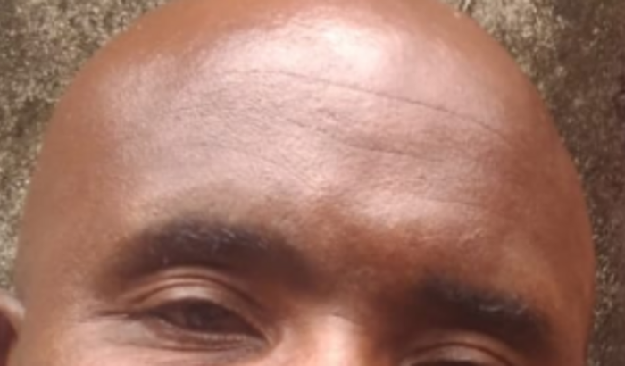 Compra coxão ortorpetico