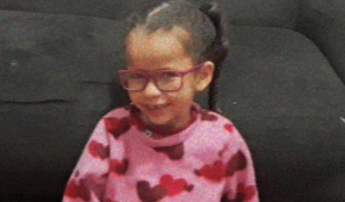 Ajuda a gente comprar a próteses e auxiliares de locomoção e tratamento da Nicole!