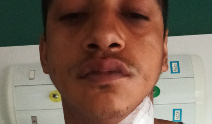 Fiz cirurgia na coluna e estou sem renda, pois minha perícia no INSS está marcada somente para fevereiro