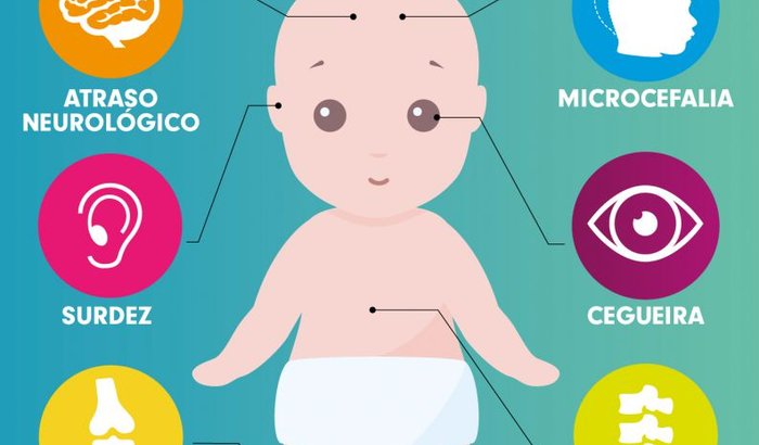 Acolhimento as crianças com a Síndrome Congênita do Zika virus