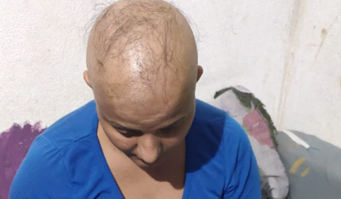 Prótese Capilar pra minha amiga Midian que tem alopecia