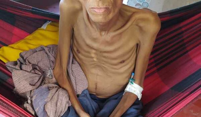 Josil luta contra o câncer