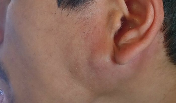 Ajuda para cirurgia do Edemir Carniel