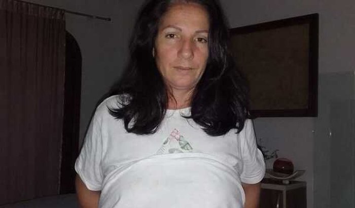 Fui vitima de arma de fogo ajuda para tirar a cicatriz que me lembra morte minha filha 