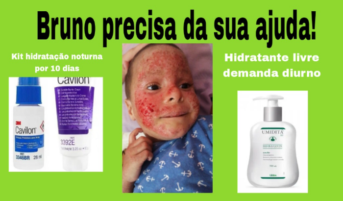 Bruno precisa de todos!