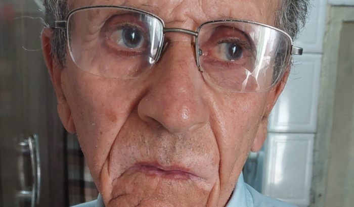 Ajude meu pai na Cirurgia de Glaucoma