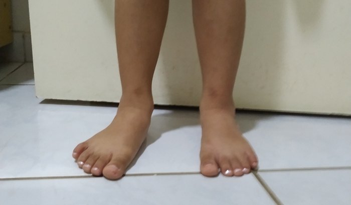 Ajuda para pequena Lalinha