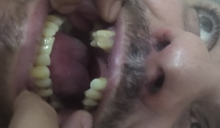 Procedimento dentário