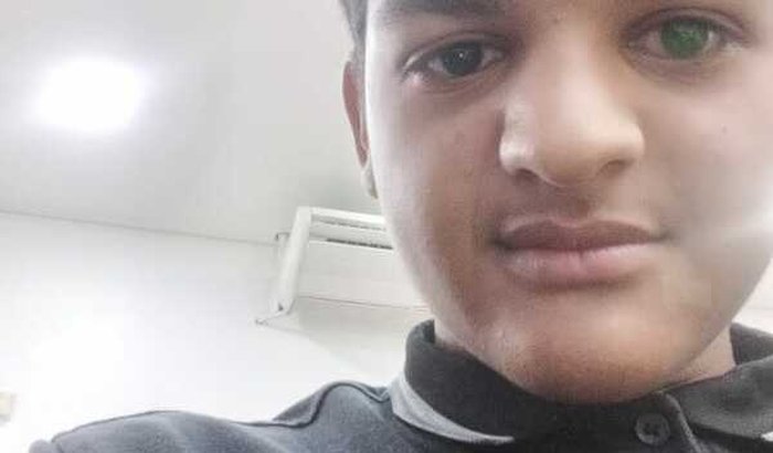 Cirurgia de ceratocone do Kauan