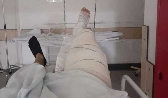 SOFRI UM ACIDENTE DE MOTO E PRECISO DE AJUDA ATE CONSEGUIR VOLTAR A TRABALHAR 