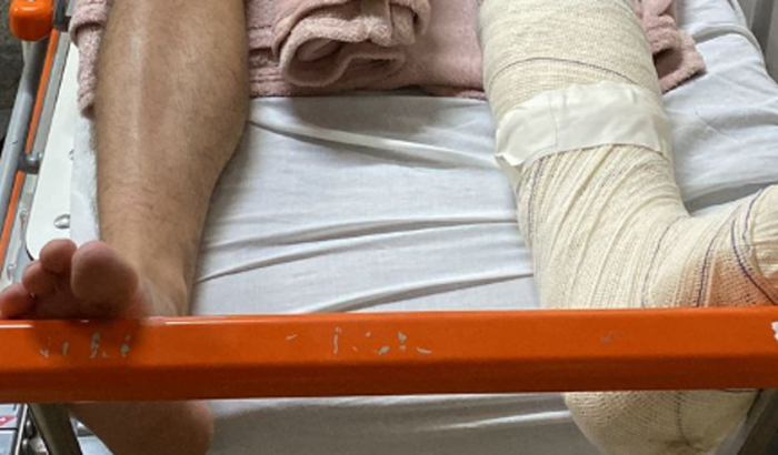 SOS CIRURGIA DO RALPH