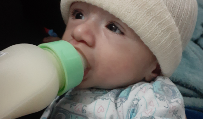 Doença tirosinemia tipo 1