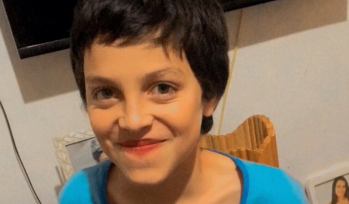 esse é o Júlio , ele precisa usar três parelhos dentários , ele sofre com  muita dor 🤕 vamos ajudar 🙏🏽🥹