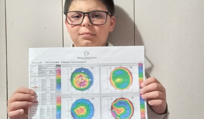 Ajuda cirurgia olho direito ceratocone lucas borges 