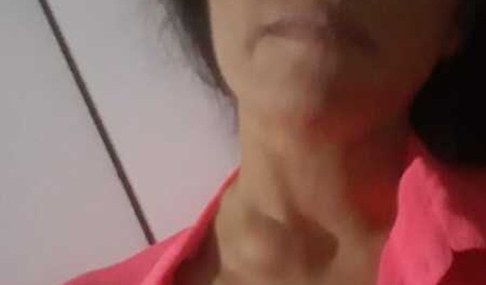 AJUDA PARA MARILDA (TRATAMENTO DE CANCER)