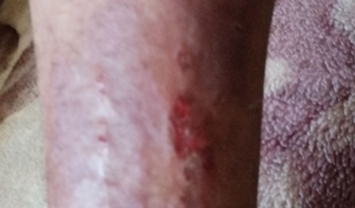 Tratamento de Lucas vilarino pissinato com exames e remédios