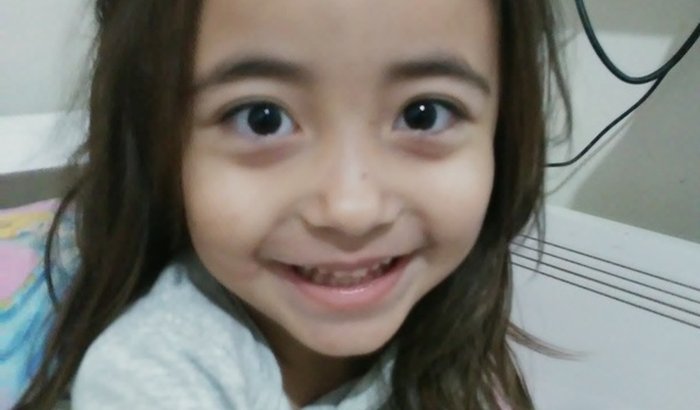 Cirurgia da Renatinha (hipertrofia das amigdalas e carne esponjosa)