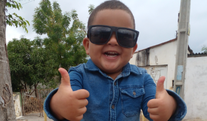 Cirurgia em prol do pequeno Isac