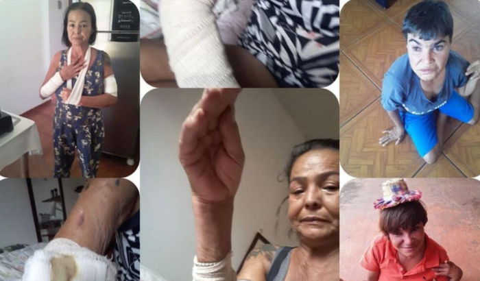 Preciso de uma cirurgia com Urgência 