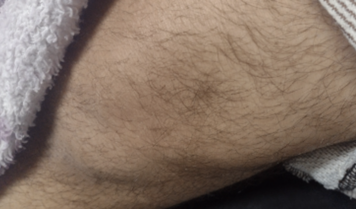 Para ajudar meu marido a fazer uma cirurgia