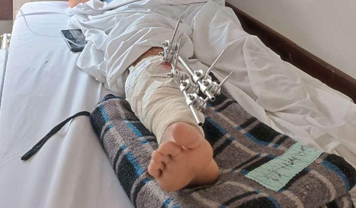 AÇÃO ENTRE AMIGOS PELO LUCIANO