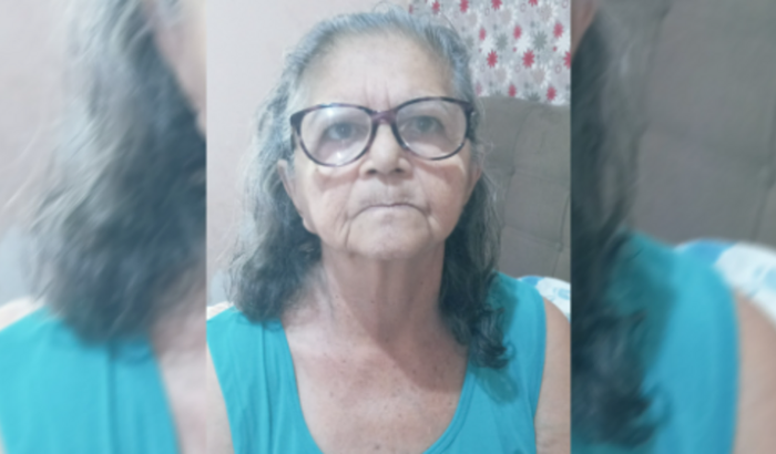 Fratura no Fêmur - Tratamento Cirúrgico