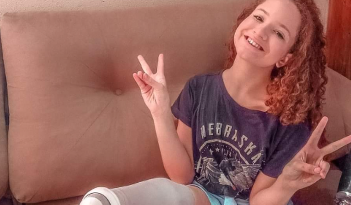 Ajuda para comprar uma prótese de perna