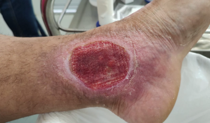 Ação em prol da cirurgia de Greicy Brito 