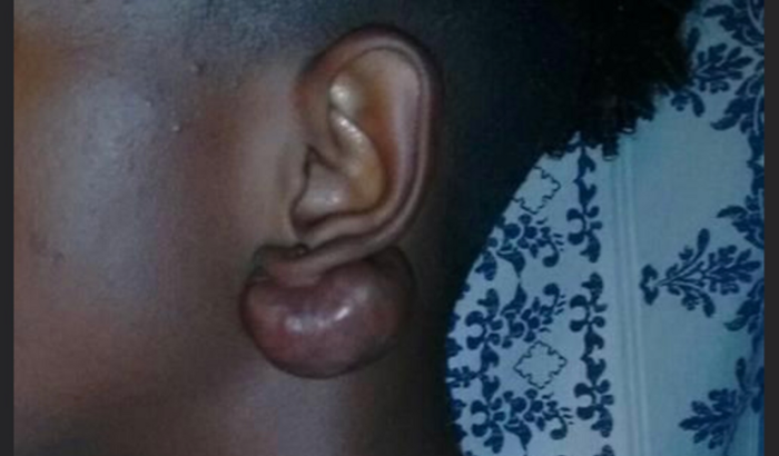 Ajuda para uma cirurgia